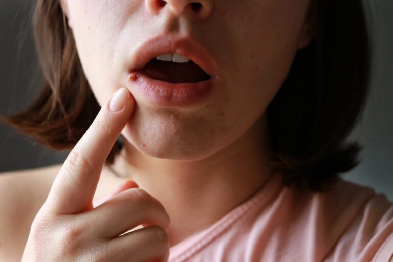 Une femme montrant une bouton au lèvre